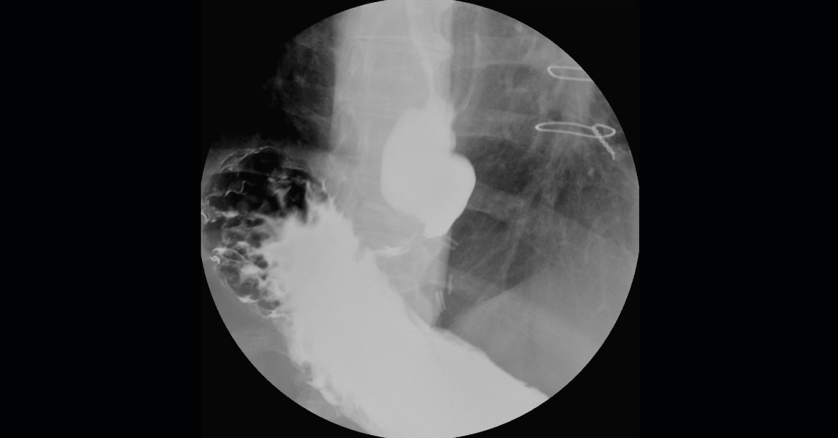 Spot The Condition