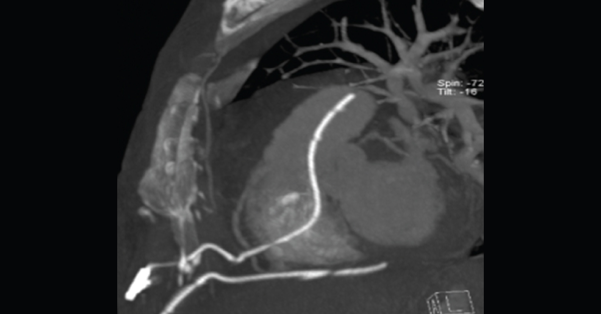 Which Procedure Is The Most Likely Cause