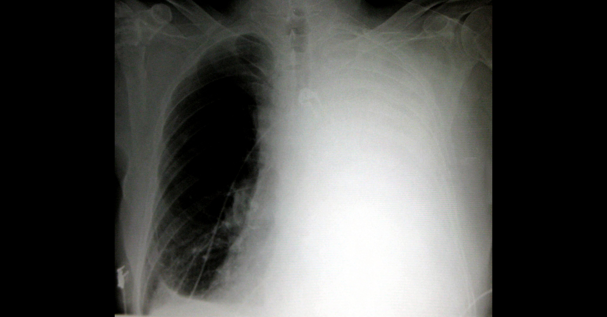 Spot the Condition