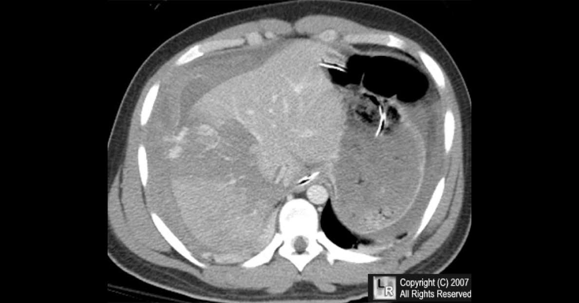Spot the Diagnosis