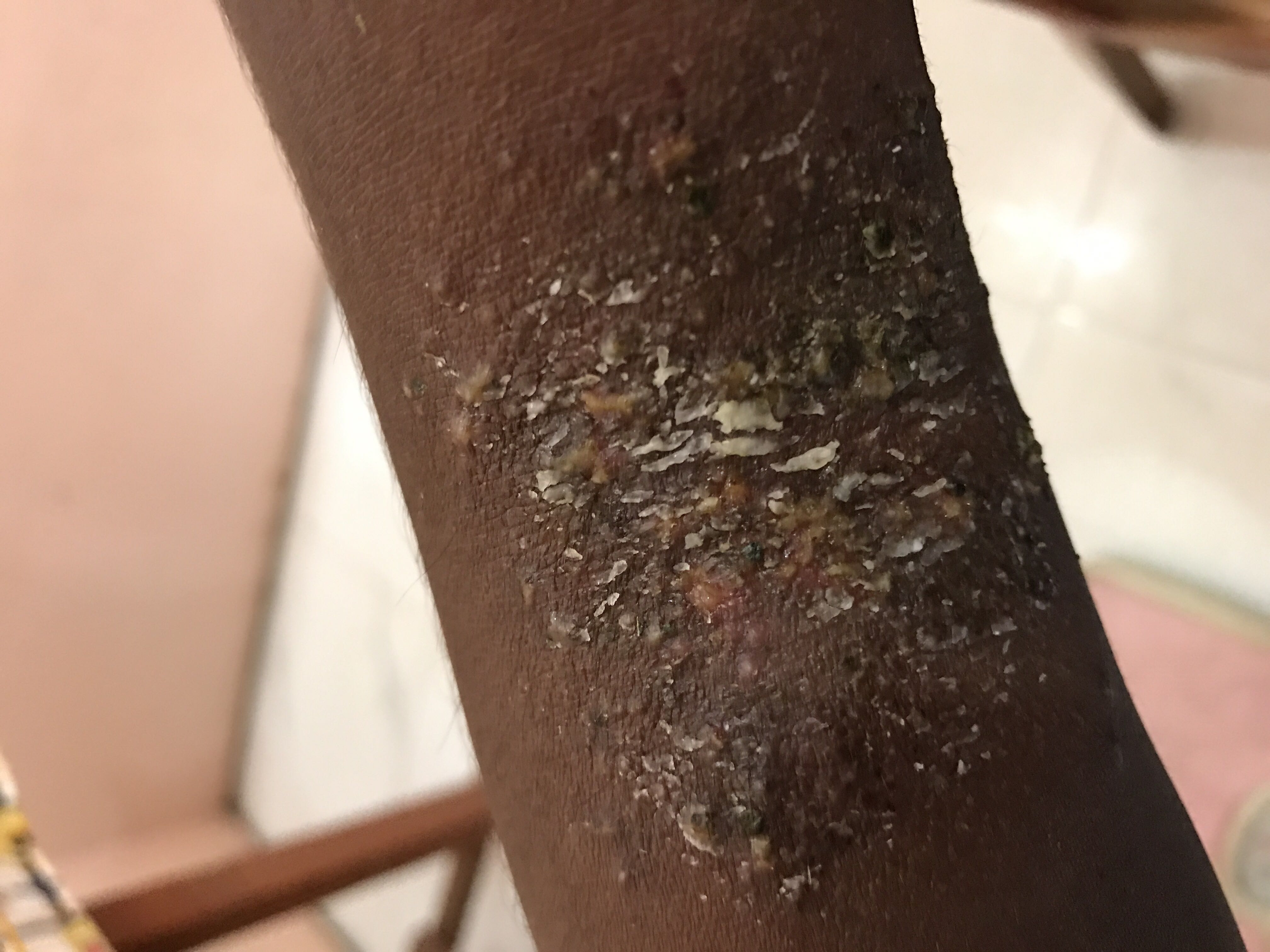 Diagnosis Of The Skin Problem 