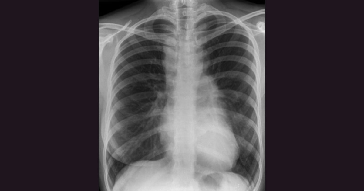 Constitutional Symptoms, Whats The diagnosis
