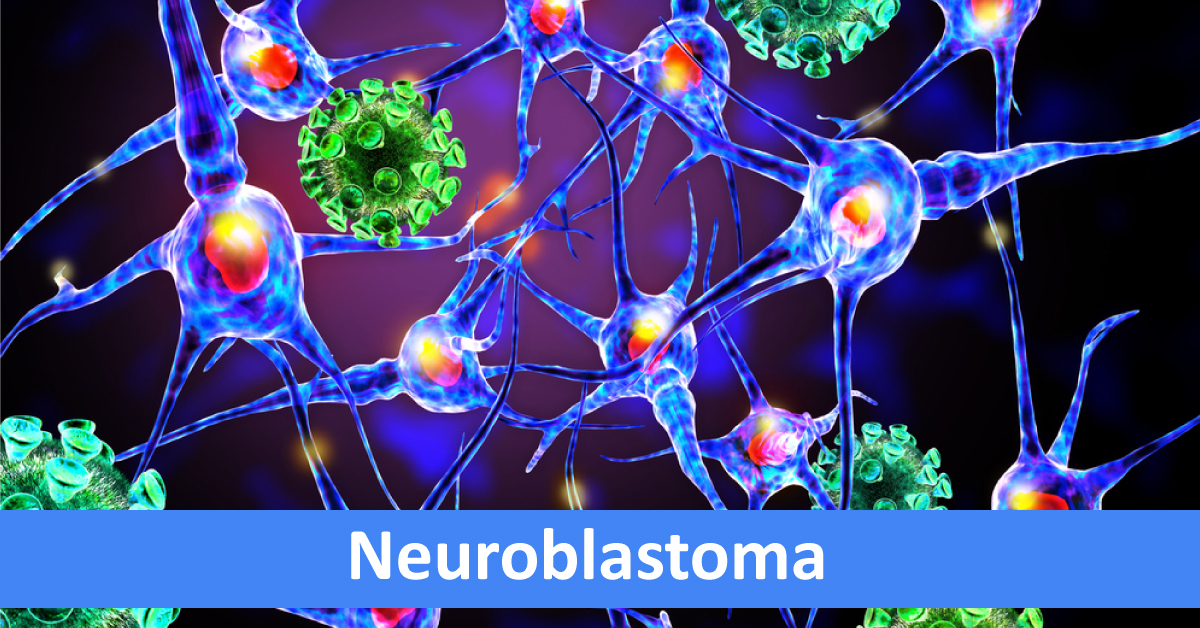 Neuroblastoma In Pediatric, Latest Advancements