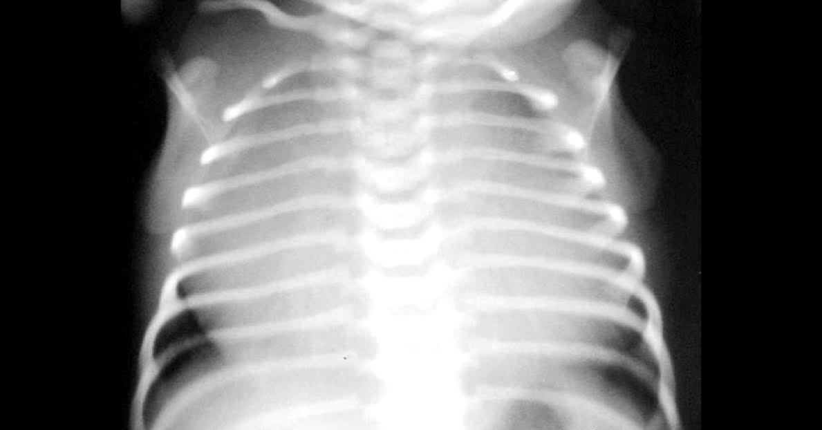Spot the Diagnosis