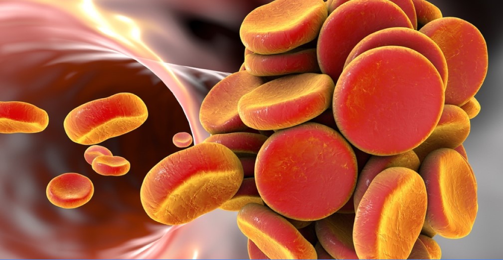 Rivaroxaban Or Aspirin In Long Term Prevention Of VTE