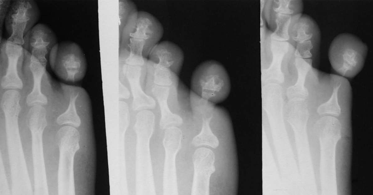 Infer Your Diagnosis For This Patient