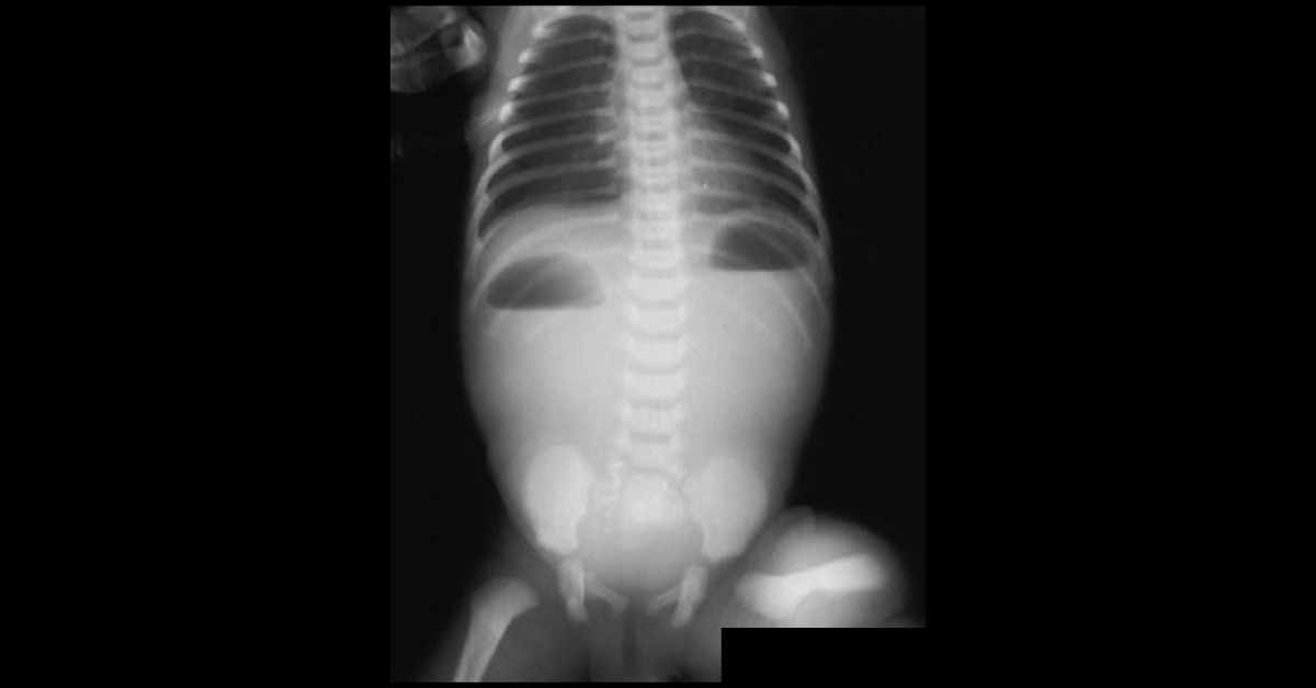 Spot The Congenital Condition