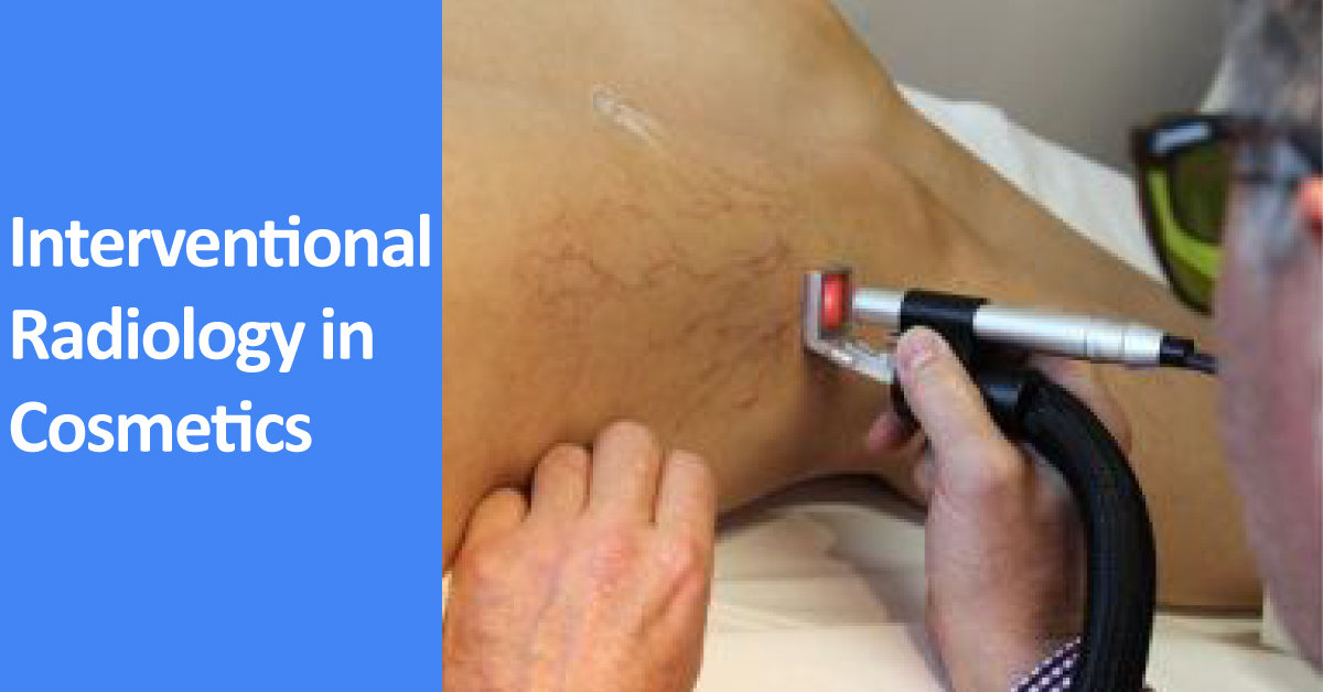 Increasing Appetite For Cosmetic Radiology