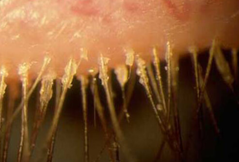 Diagnose The Lesion