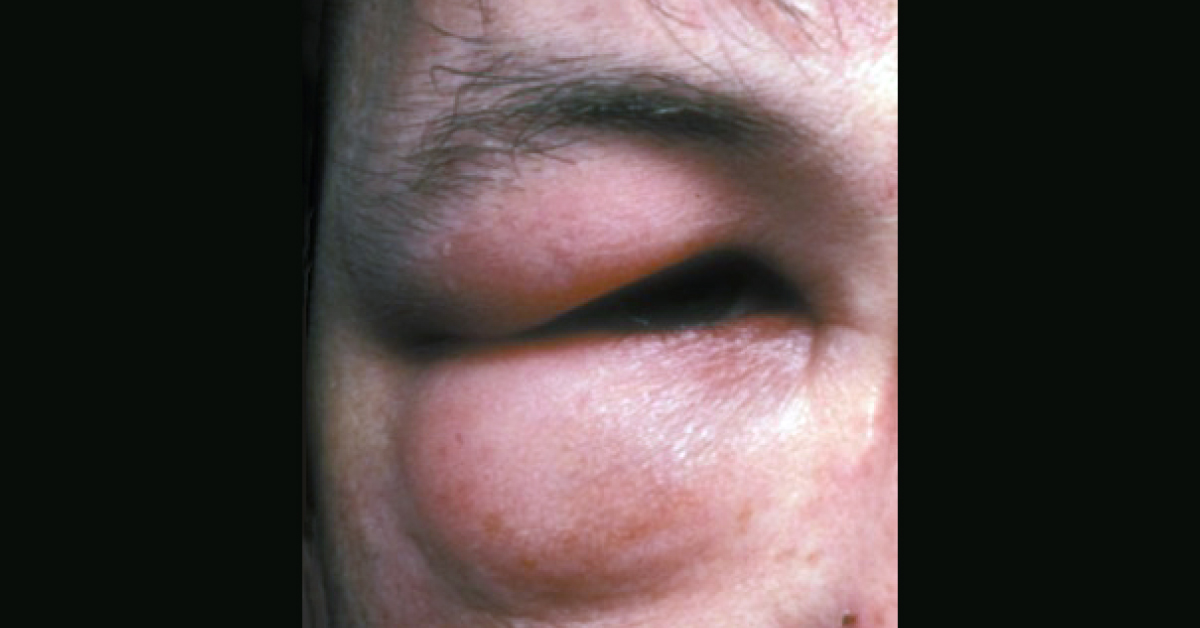 Spot The Skin Condition