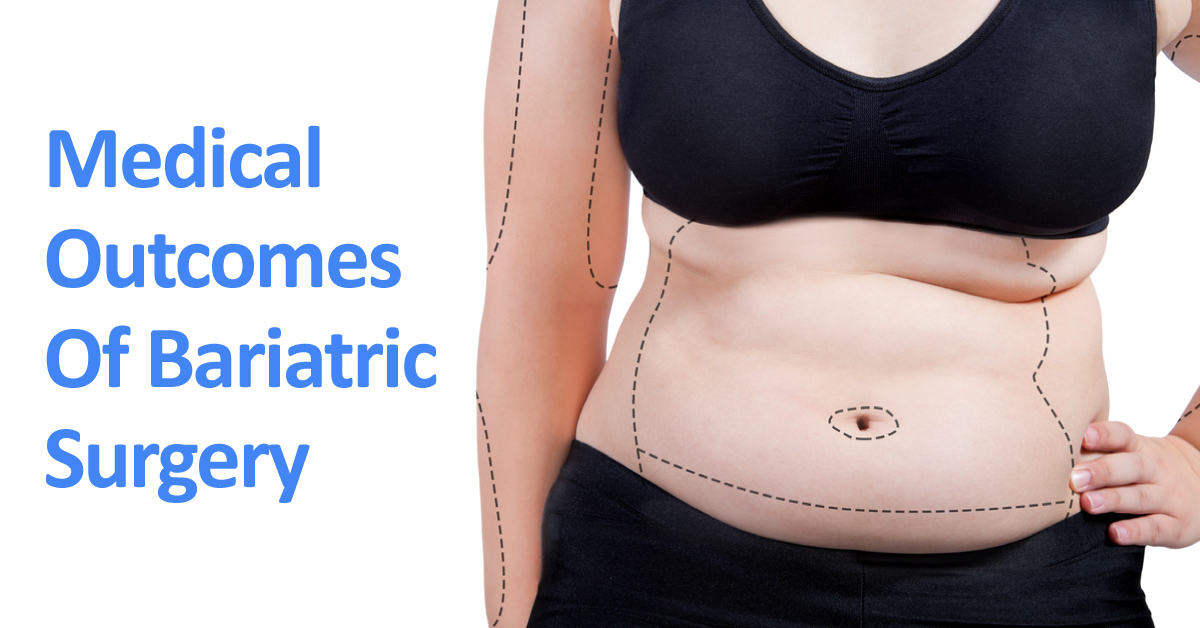 Medical Outcomes Of Bariatric Surgery Beyond Weight Loss