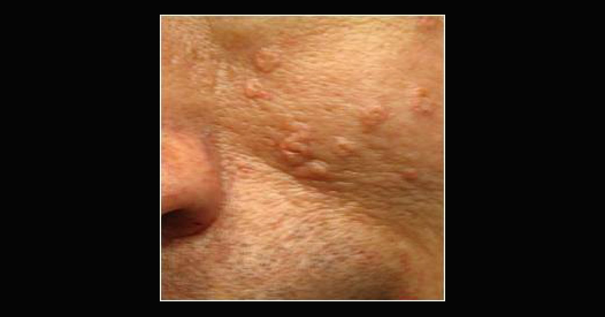 Spot The Dermal Condition
