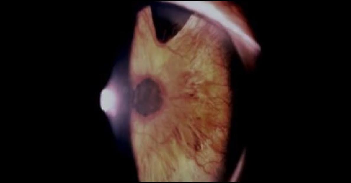 Spot The Ophthalmic Condition