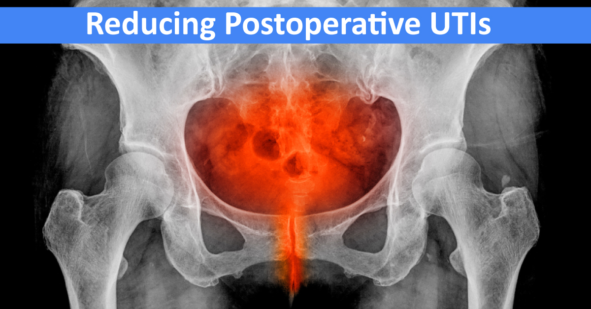 Strategies To Reduce Postoperative UTIs