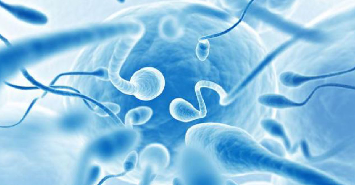 No More Vasectomy, A Switch In Spermatic Cord Developed For Contraception