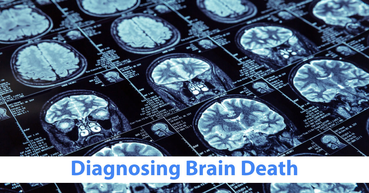 Diagnosing Brain Death