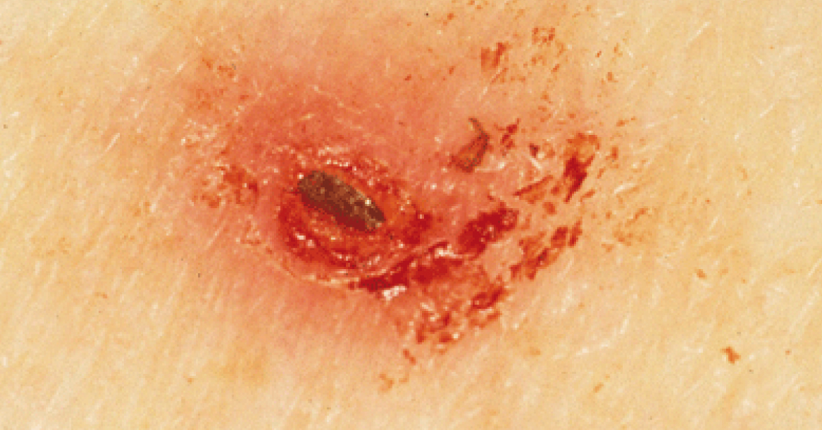 Diagnose The Condition