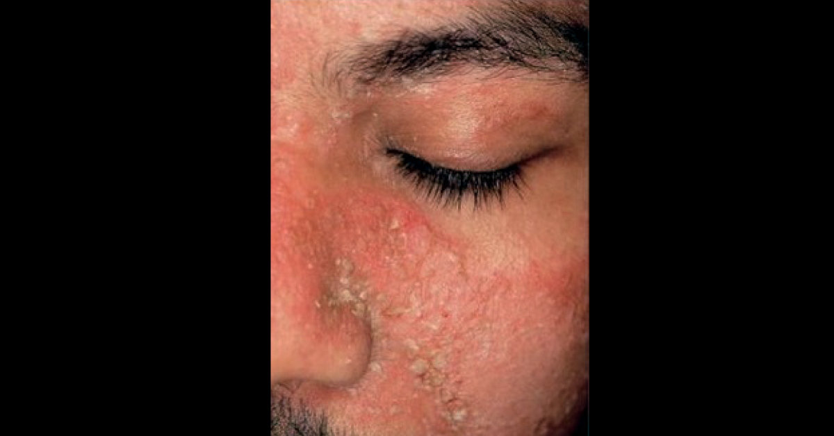 Spot The Dermal Condition