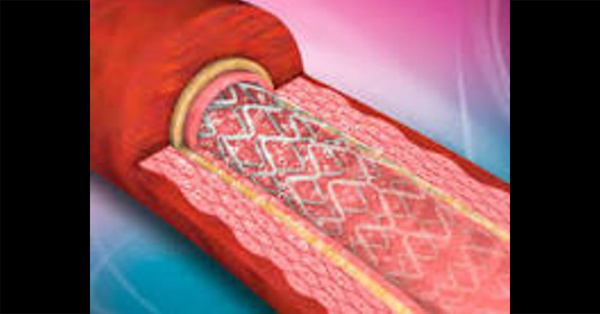 Banned Medical Devices Are Dumped In India