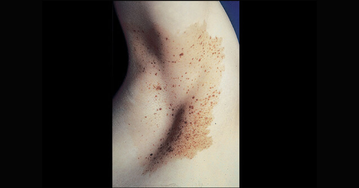 Spot The Condition
