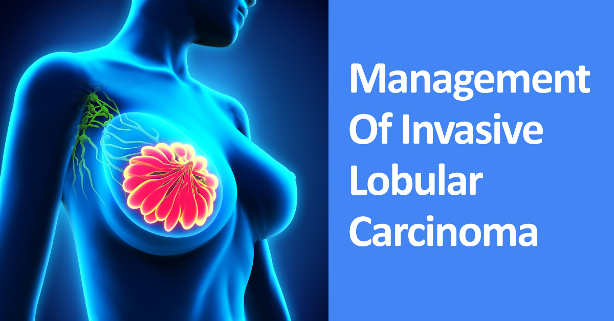 Management Of Invasive Lobular Carcinomas