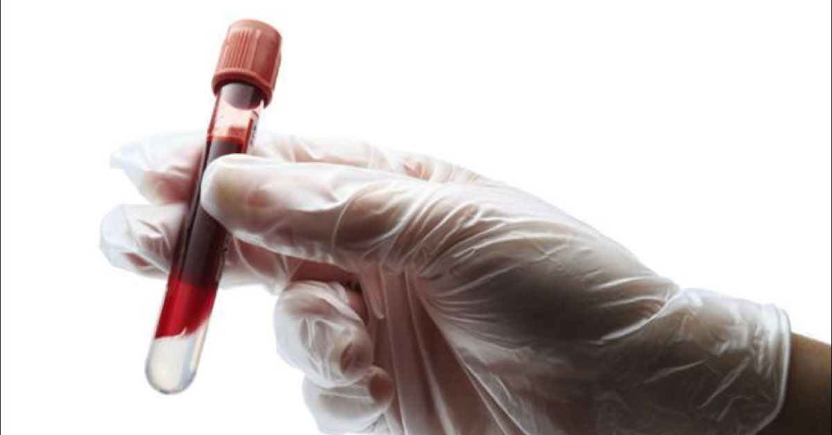 A Blood Test May Predict Lifespan