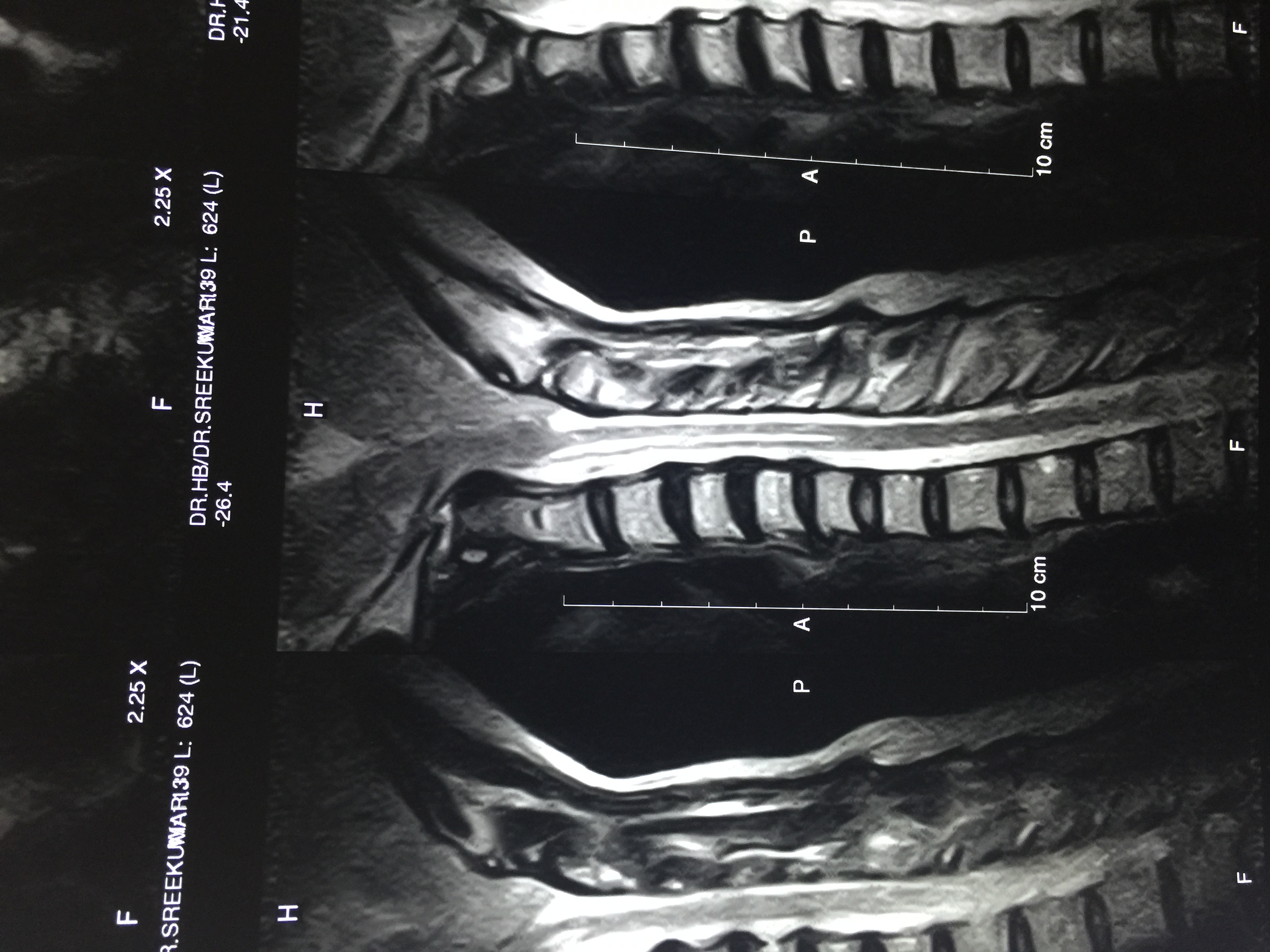 Imaging Diagnosis