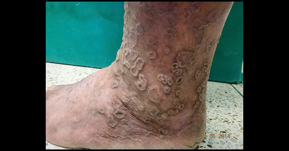 Spot The Condition