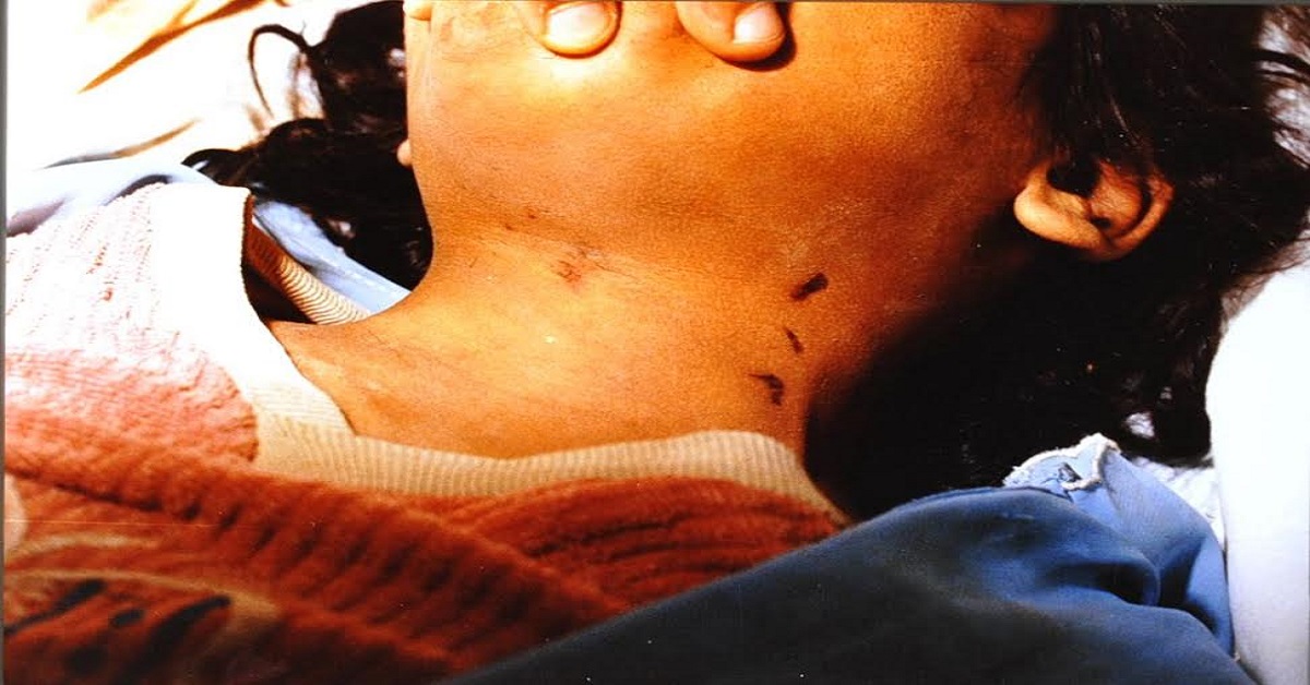 What Is The Significance Of The Postmortem Findings