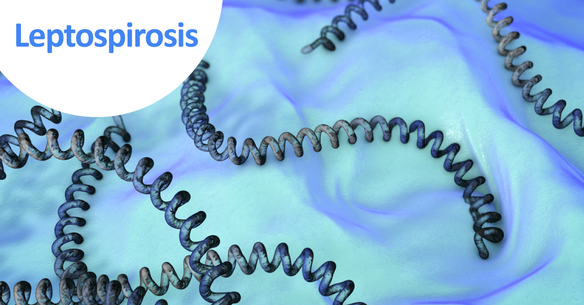 Leptospirosis, Approaches For Diagnosis And Management