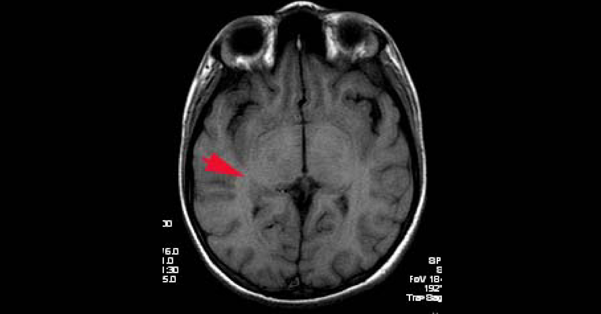 Identify The Condition