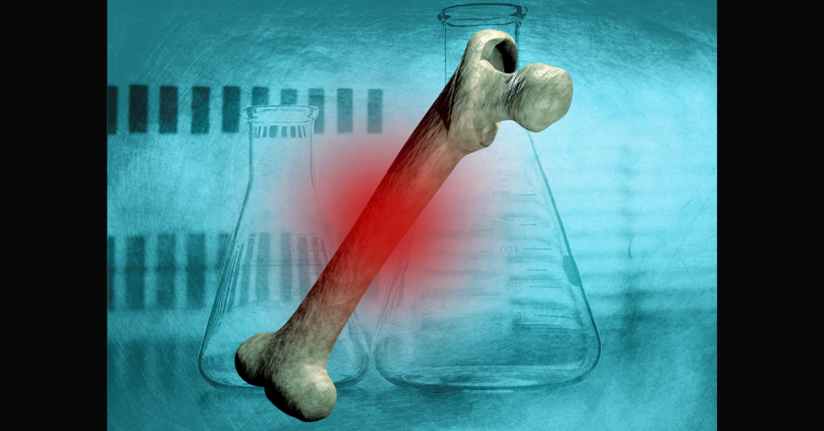 Estimation Of Stature From Long Bones In Forensic Examination