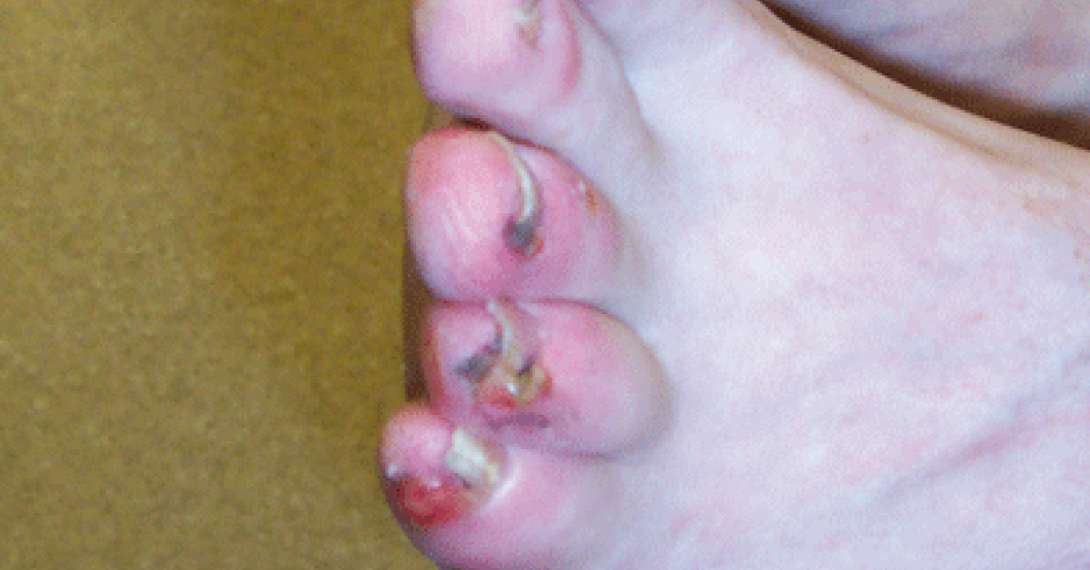 Diagnose An Unexpected Case
