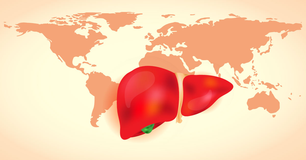 Alcoholic Liver Disease : European Association Guidelines