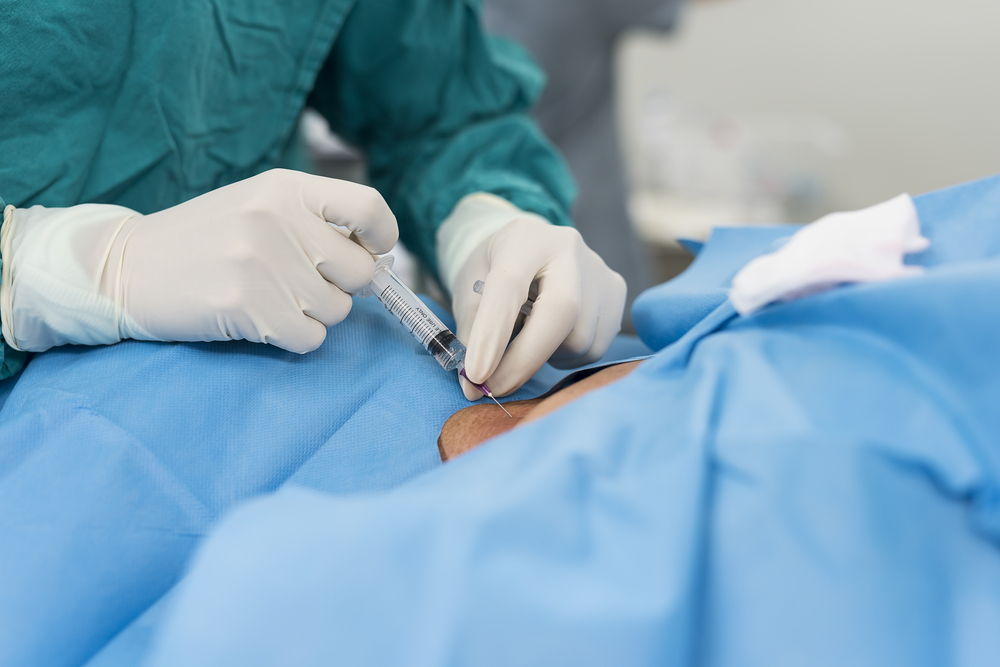 Need Of Sensitivity Testing Of Local Anesthetic Agents