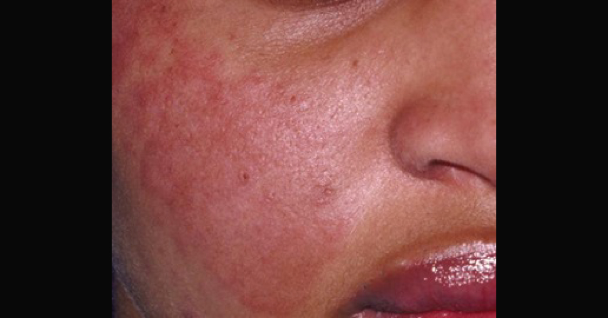 Infer The Diagnosis For This Case