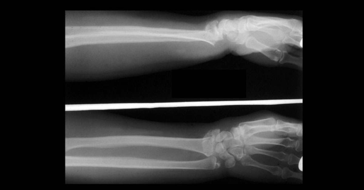 Identify the Condition From The Radiograph