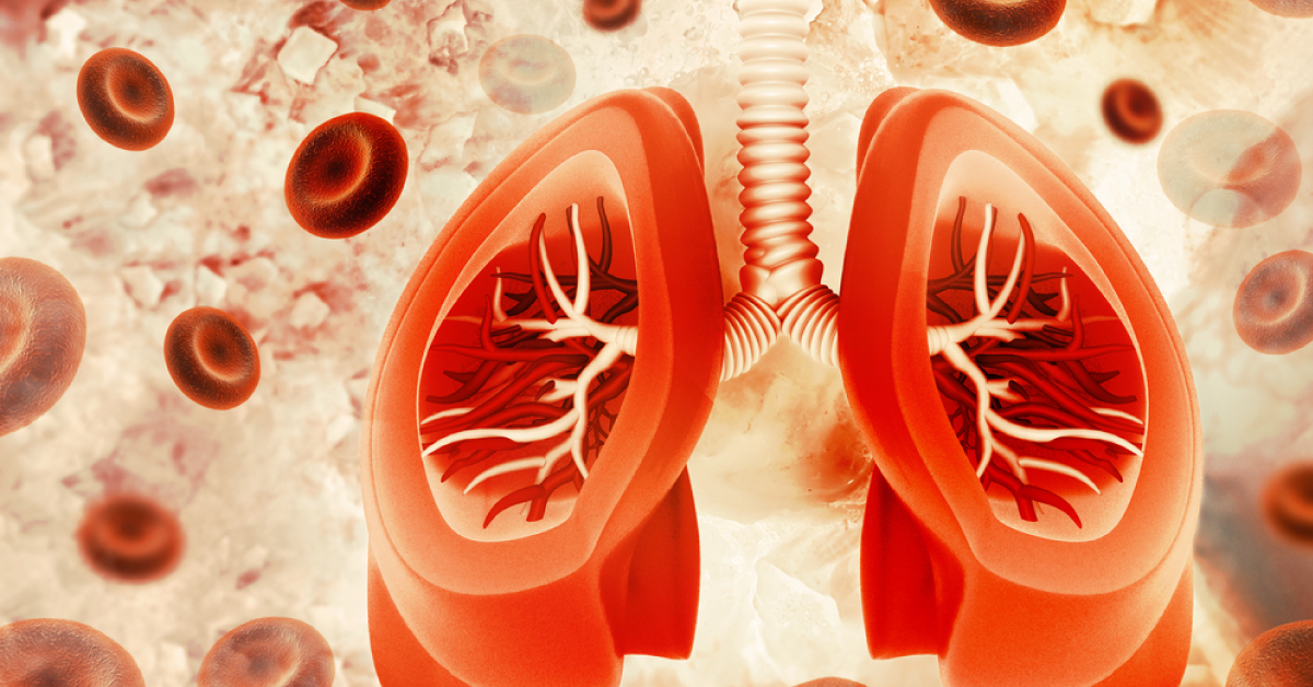 Pulmonary Hemorrhage In Pediatric Patients