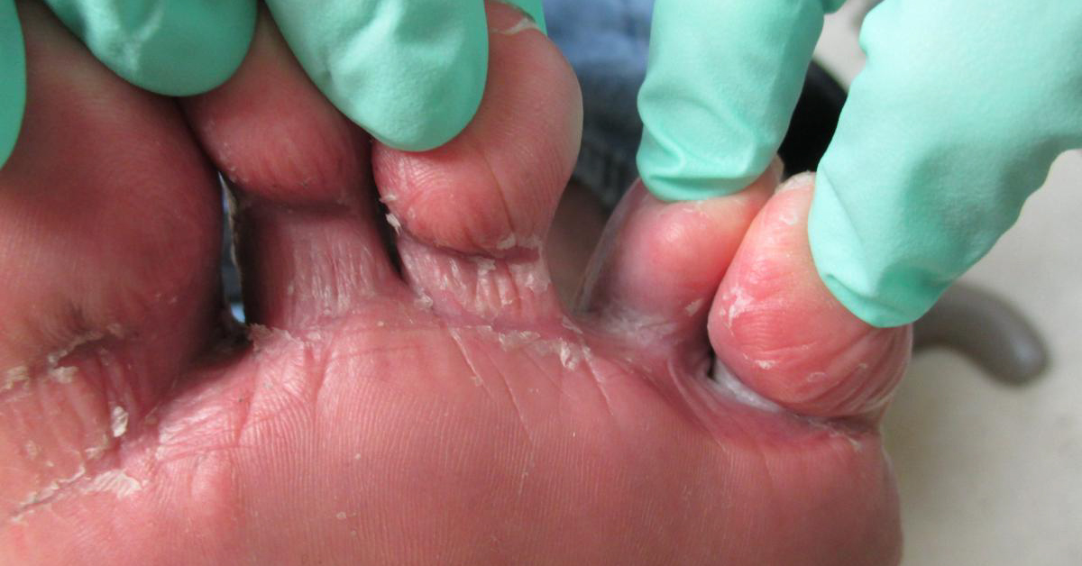 Treat The Podiatric Condition