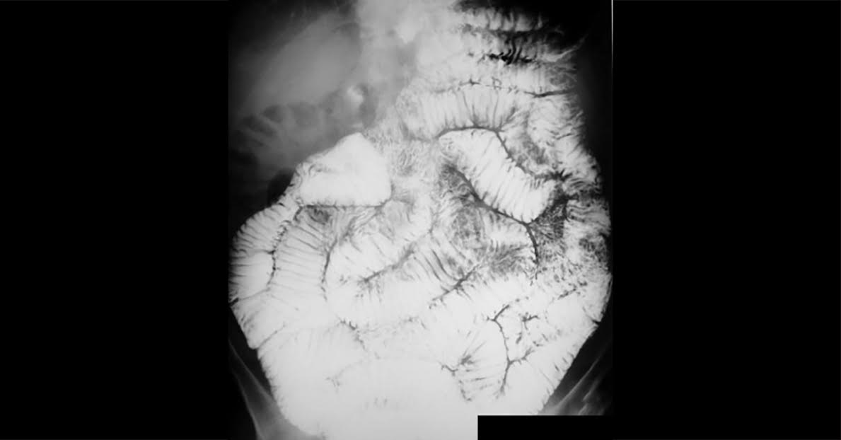 Identify The Abnormality