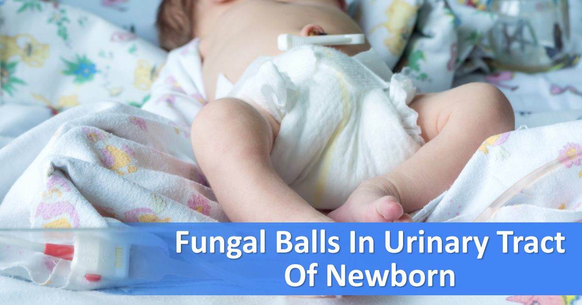 Systemic Fungal Infections In Neonates