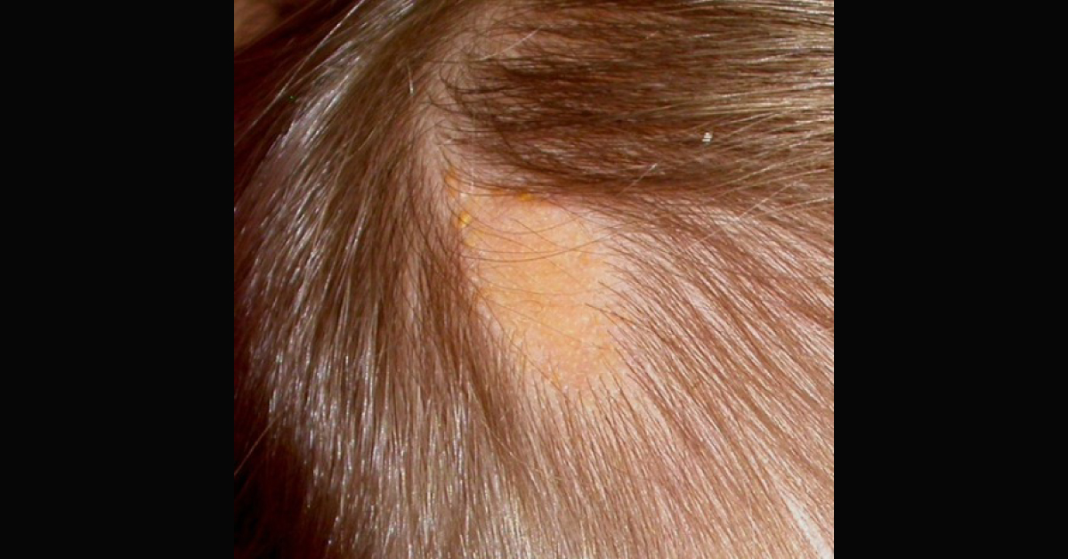 Spot The Diagnosis From Image