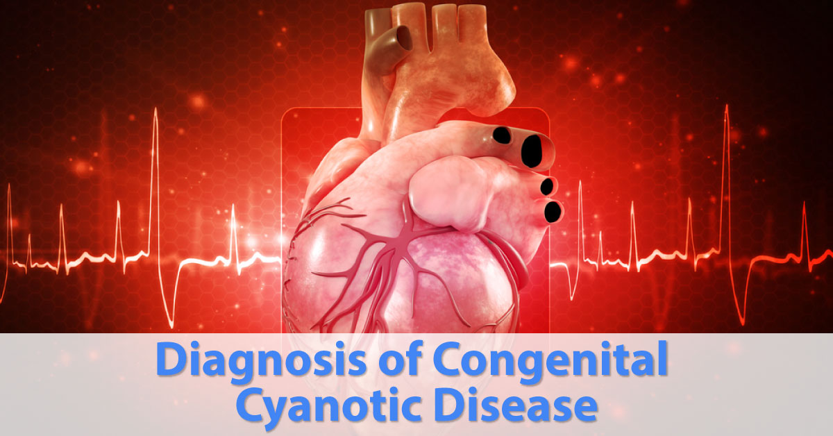 Diagnosis Of Congenital Cyanotic Diseases