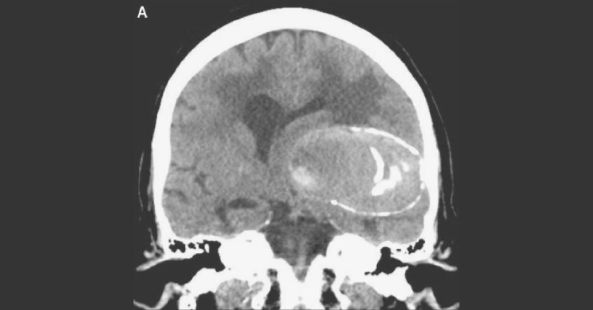 Diagnose The Condition From CT And MRI Images