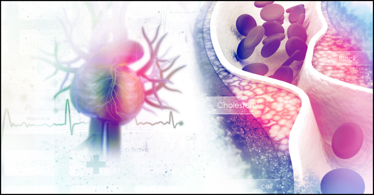 Platelets Level, Epidemiological Tool For Screening Of Stroke And CAHD