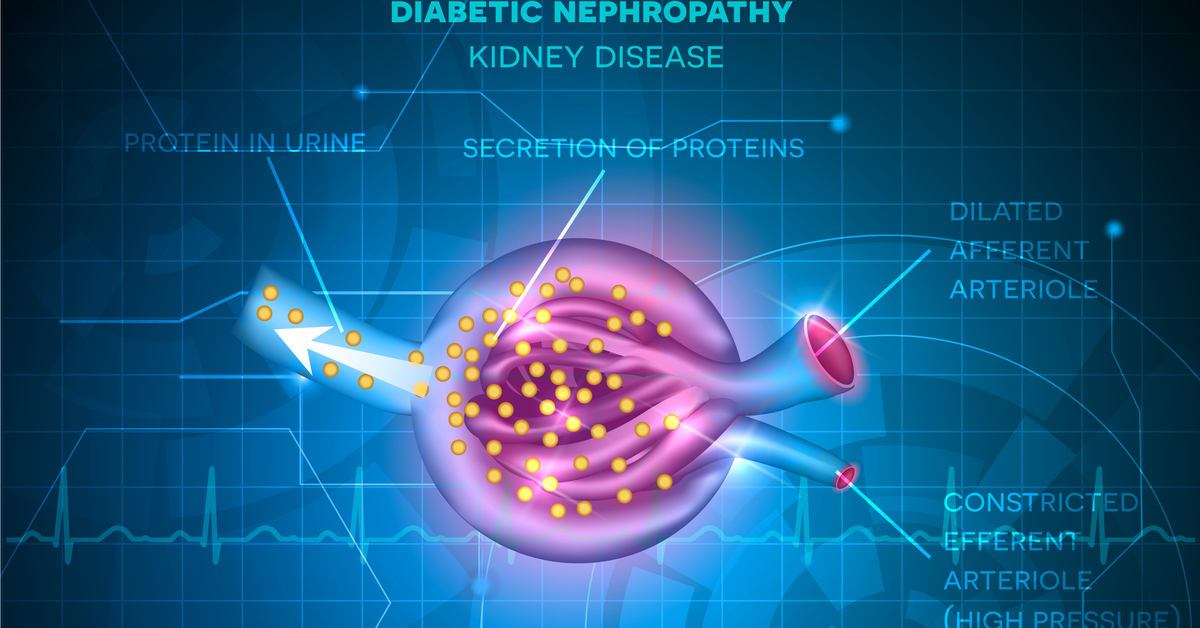 Prevention And Management Of DKD In Family Practice