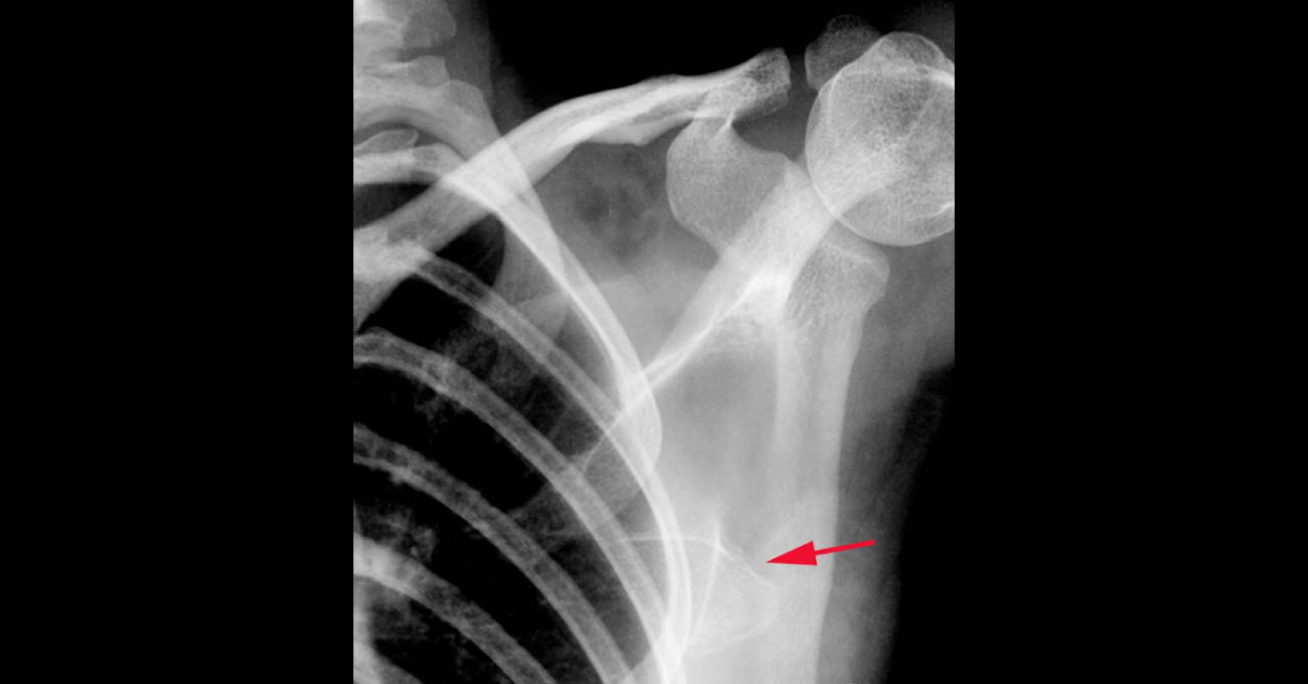 Spot The Condition