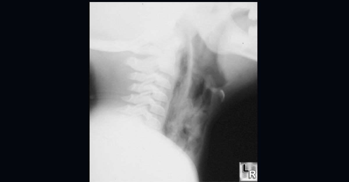 Diagnose From The Radiograph
