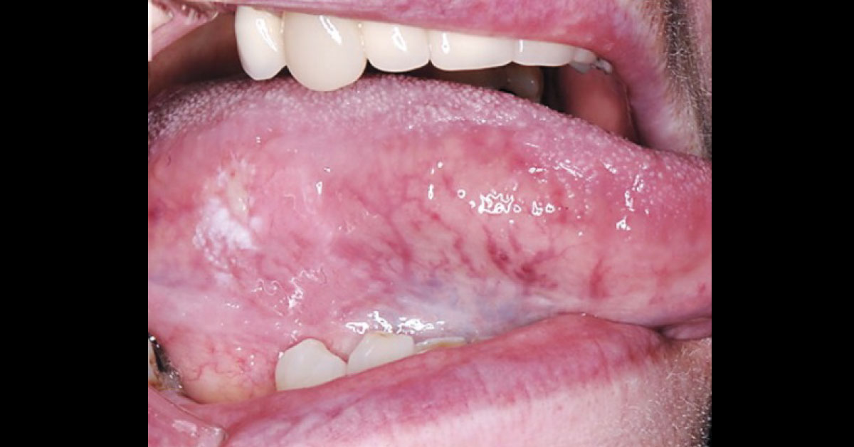 Identify The Oral Condition