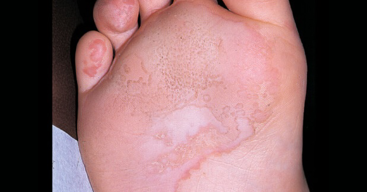 Identify The Condition